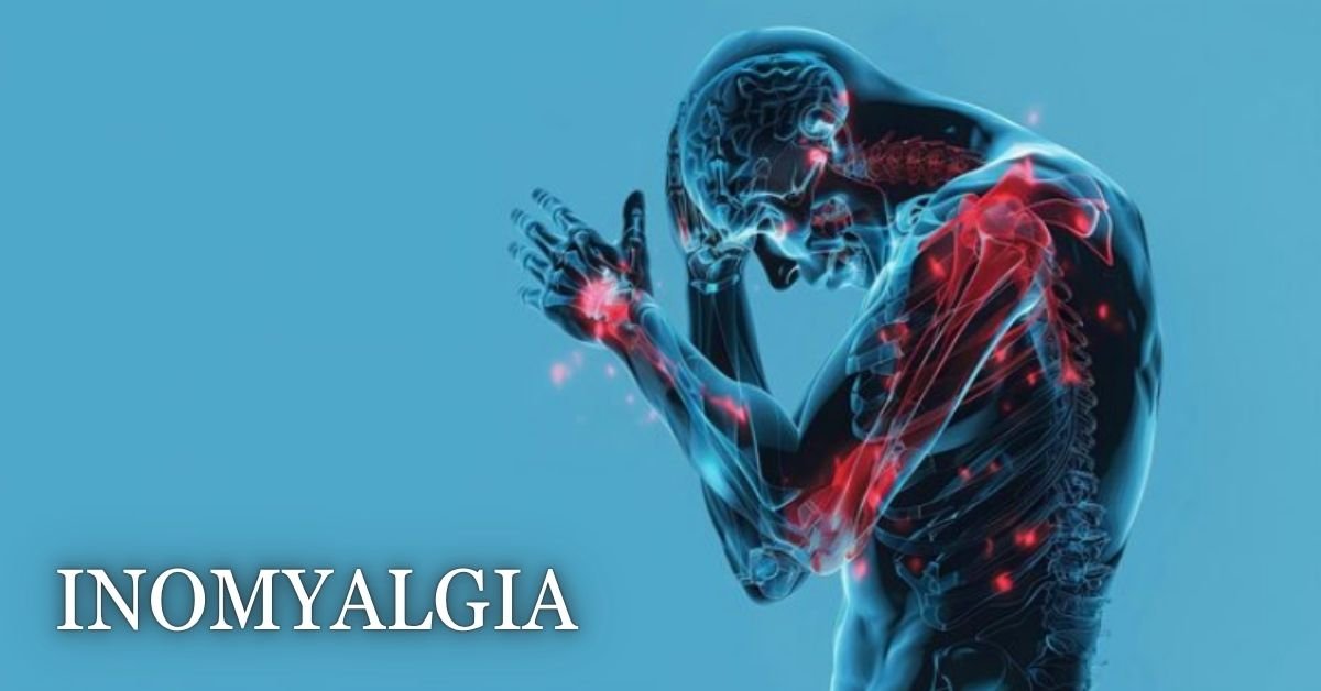 Inomyalgia: Understanding Muscle Pain and Its Hidden Causes